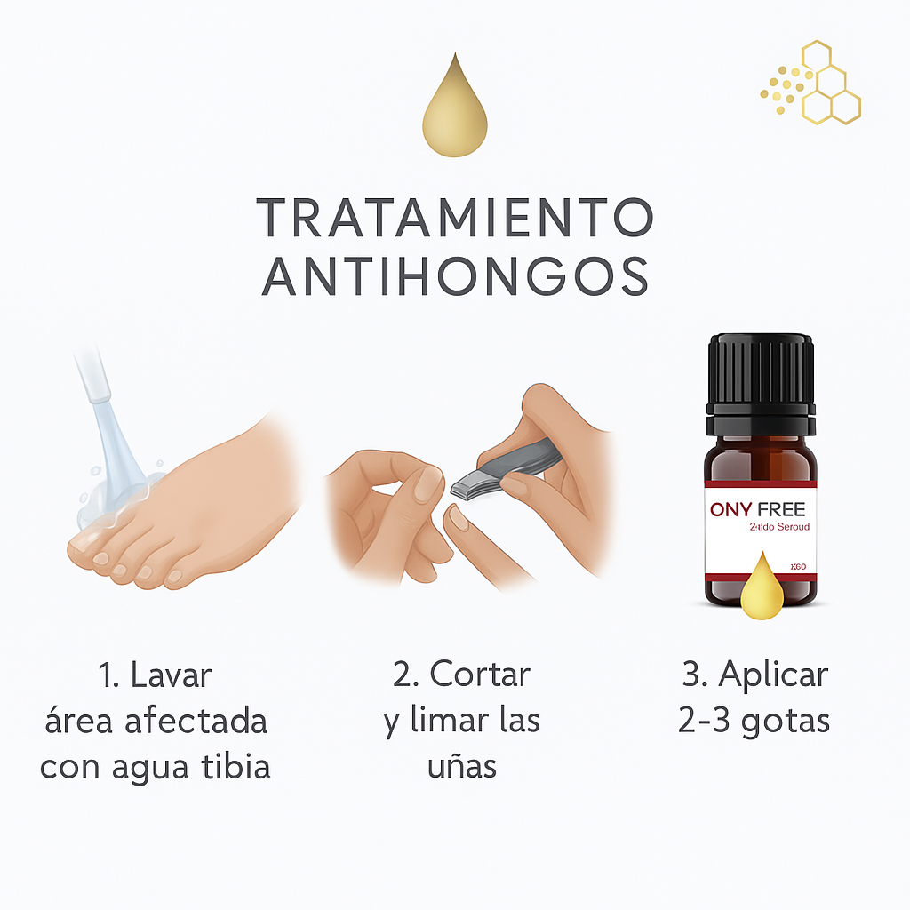 ¡Promoción especial! - ONYFREE - Antihongos Uñas 10ml