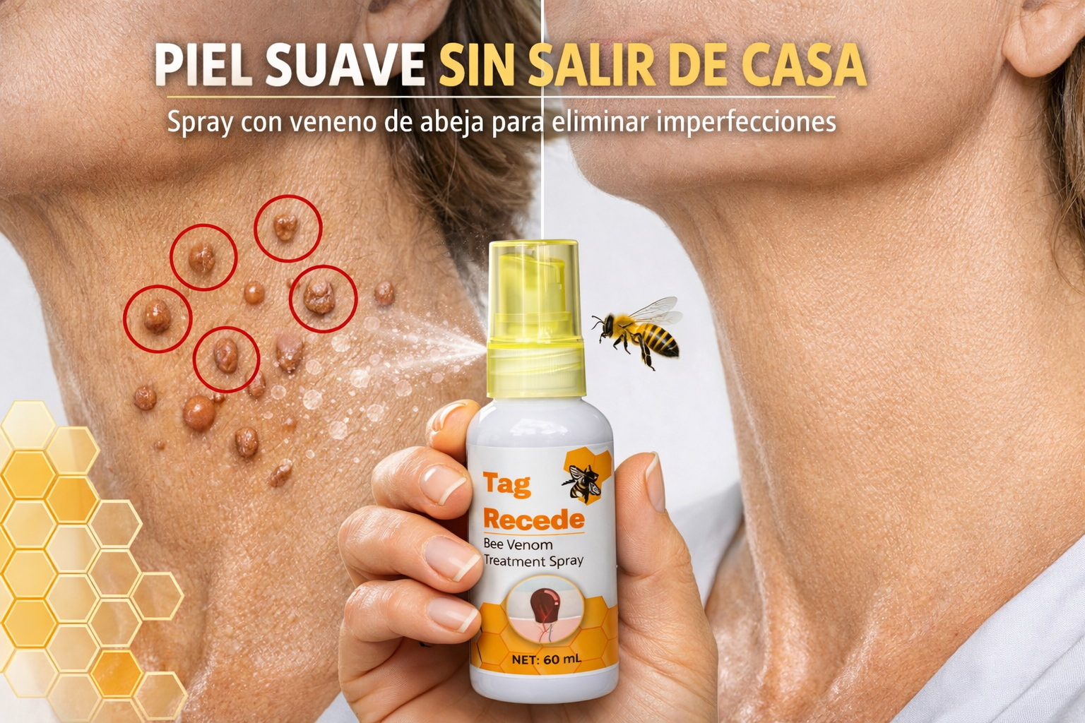 Tag Recede  Spray para eliminar verrugas