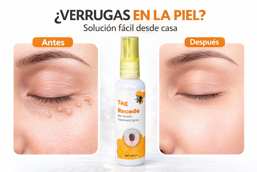 Tag Recede  Spray para eliminar verrugas
