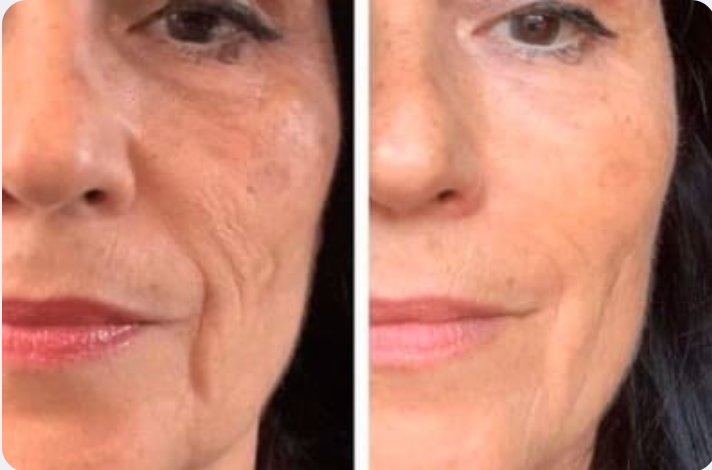 AFRODITA KIT ANTI EDAD